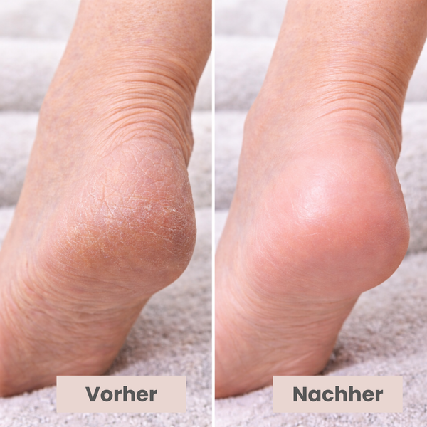 Scham Sandalen